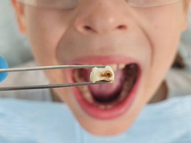 Best Urgent Dental Care for Toothaches in Arnaudville, LA